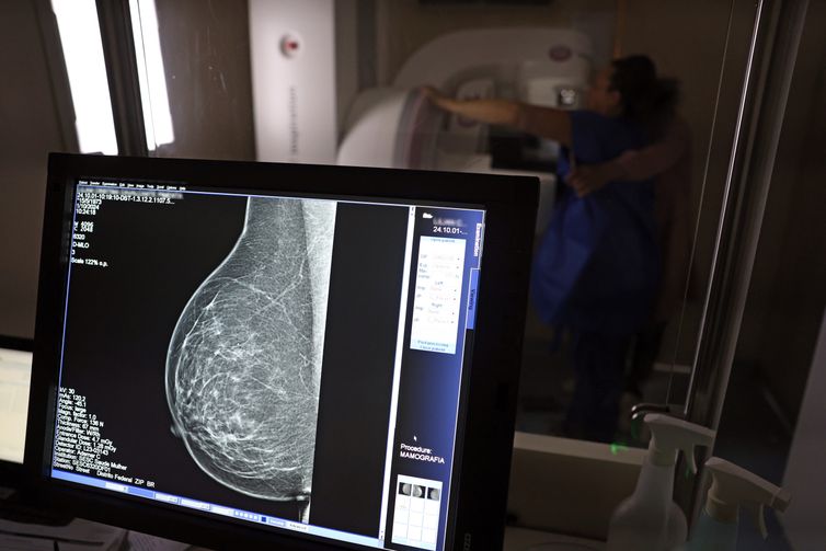 Periodicidade de mamografias divide médicos e autoridades de saúde